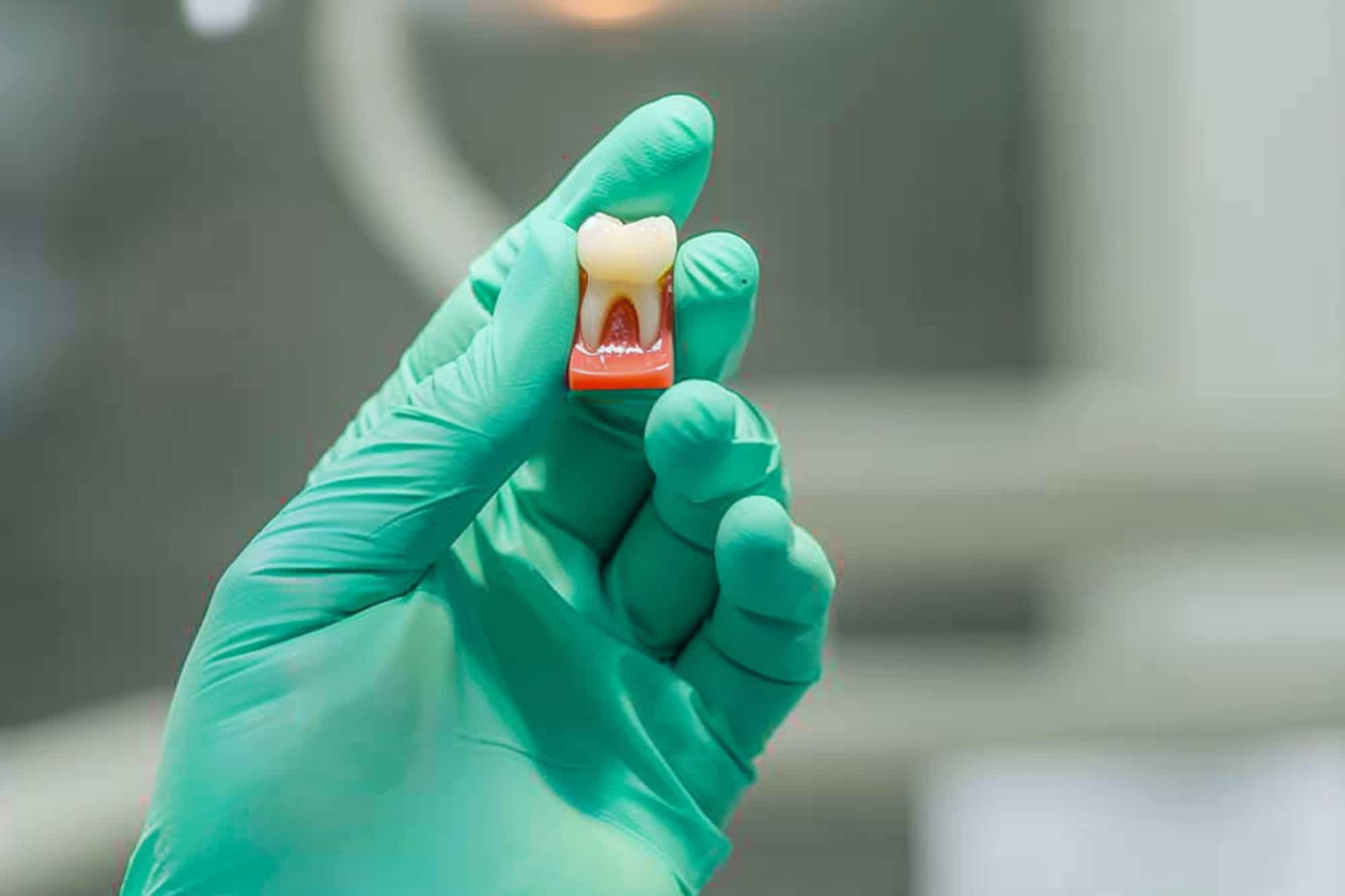 A closeup shot of the dentist's gloved hand holding a fake knocked-out tooth